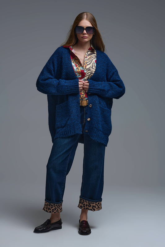 Q2 Cardigan oversize en marine avec boutons et poches dorés